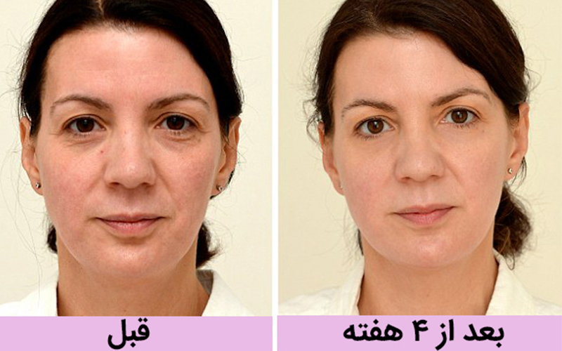 تاثیر نوشیدن آب بر روی سلامتی