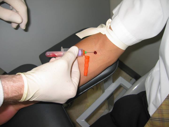 hemophilia-test.jpg