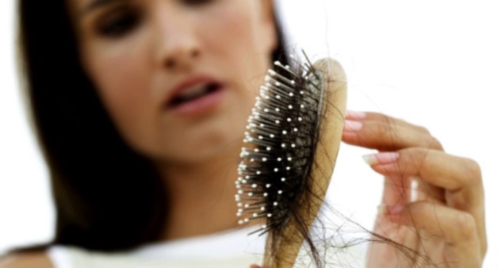 علت ریزش مو - ریزش مو در دوران نوجوانی