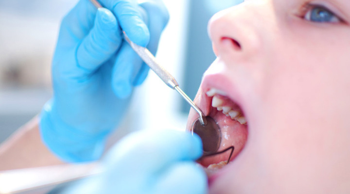 Tooth enamel - treatment of tooth enamel damage